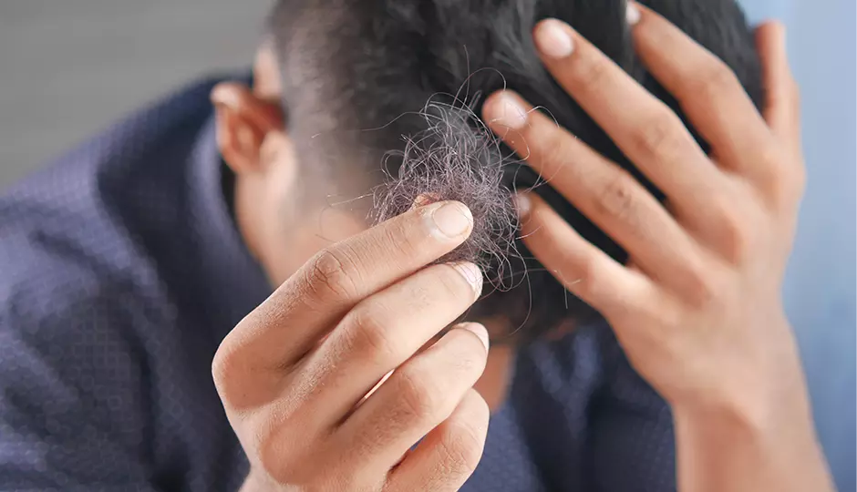 Hair Shedding Is Different Than Hair Loss