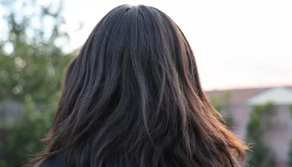 Why People With Hair Loss Should See a Hair Loss Specialist